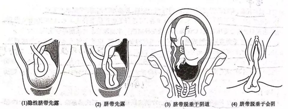 騰訊新聞