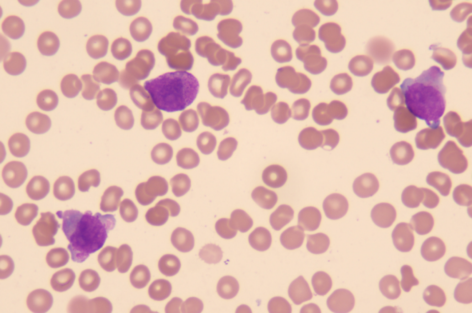 血常规用什么仪器检查患者入院要求弃胎，万万没想到血常规竟隐藏了 1 个致命信号！_https://www.jmylbn.com_新闻资讯_第3张