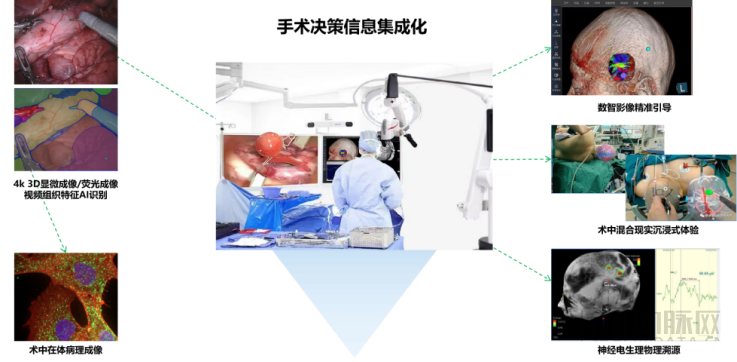什么是等离子治疗仪北卓医疗：构筑“一体两翼”跨模态智联闭环生态，占据中国神经科学数智化浪潮先发身位_https://www.jmylbn.com_新闻资讯_第2张