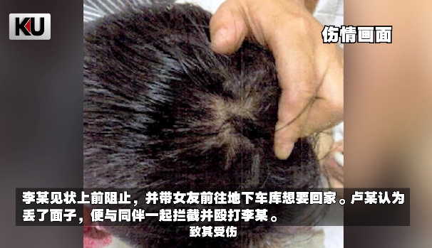令人气愤！醉汉调戏女服务员还打伤其男友_腾讯新闻