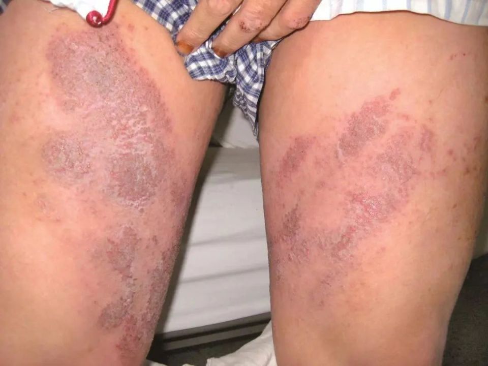 屁股上摸到的小凸起,到底是啥啊?