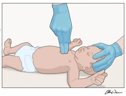 纱布为什么能止血这12种常见意外你会处理吗？收藏这份居家“救命”手册_https://www.jmylbn.com_新闻资讯_第3张