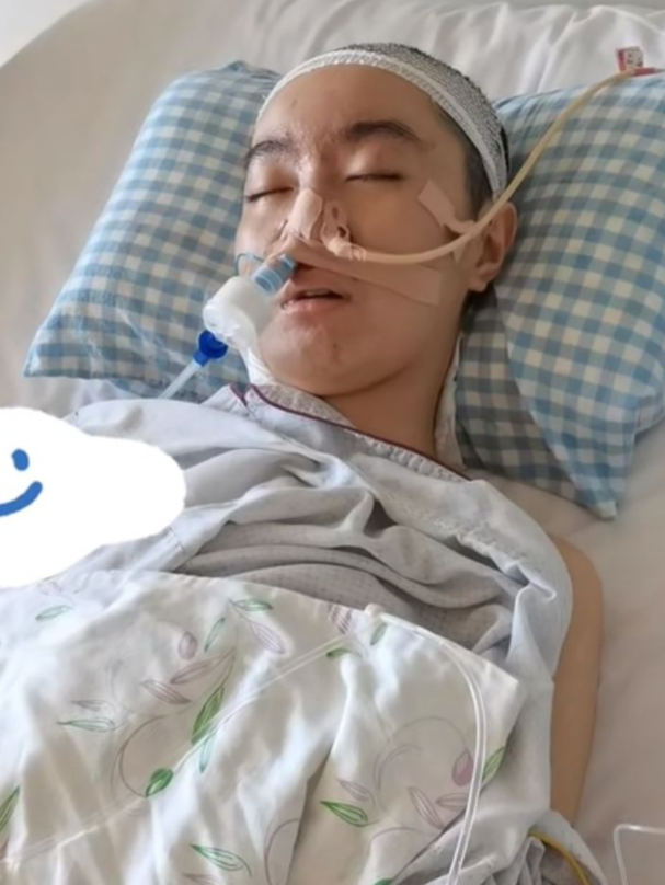 高君雨开颅手术后状态变差,嗜睡持续发烧,紧急转入icu