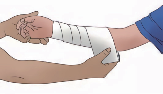 周末说健康|应对创伤,必学的止血法