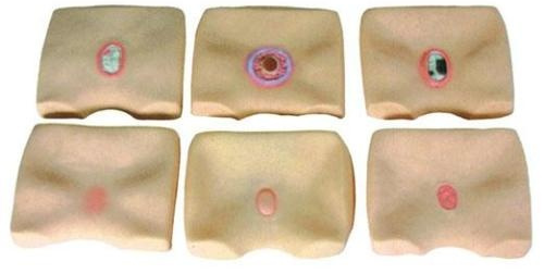 一文了解压疮的护理