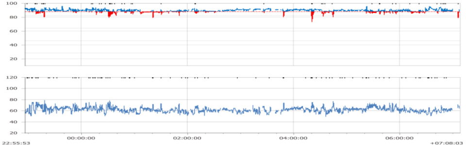呼吸机怎么打开Ⅱ型呼吸衰竭又陷诊断困局……当室速撞上呼吸“牢笼”，如何通过破解隐匿的神经肌肉密码打开思路，拨云见日？丨疑案探密（161）_https://www.jmylbn.com_新闻资讯_第6张