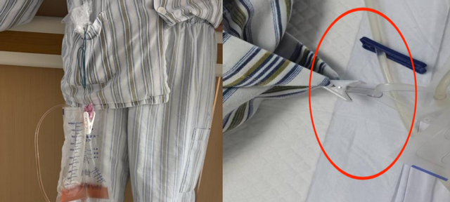 医院引流袋怎么操作小物件大温暖，北京世纪坛医院泌尿外科护理团队巧解患者“引流之困”_https://www.jmylbn.com_新闻资讯_第3张