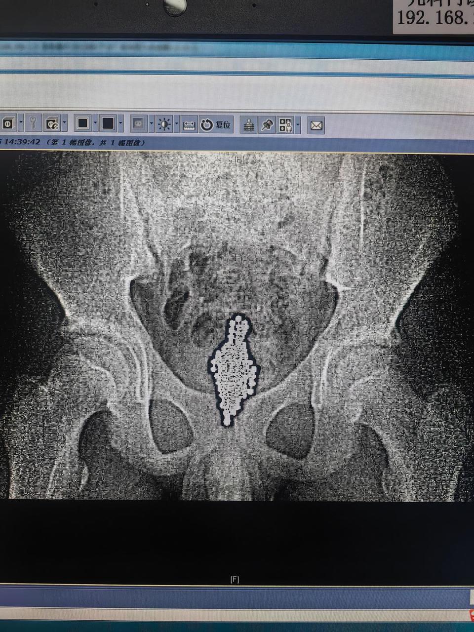 磁力珠对身体有辐射吗有害吗的简单介绍 磁力珠对身材有辐射吗有害吗的简单先容（磁力珠有没有辐射） 磁力资讯