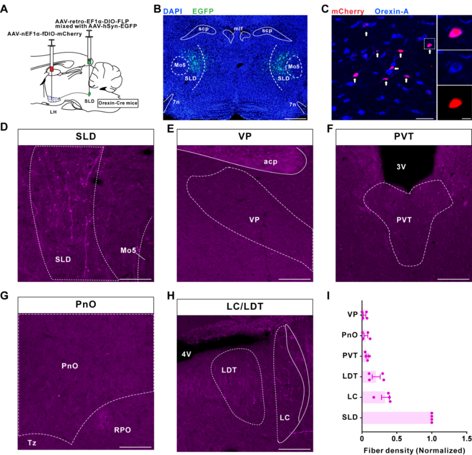 research︱陆军军医大学张骏/胡荣团队揭示下丘脑-蓝斑底核食欲素神经