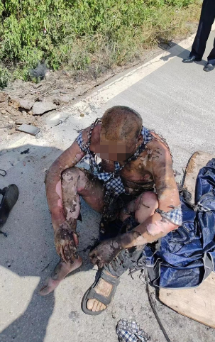 惨全身被烧焦广西一男子钓鱼甩杆事不慎触碰高压线