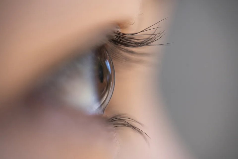 这些眼睛问题,可能是其他身体疾病的"信号"!