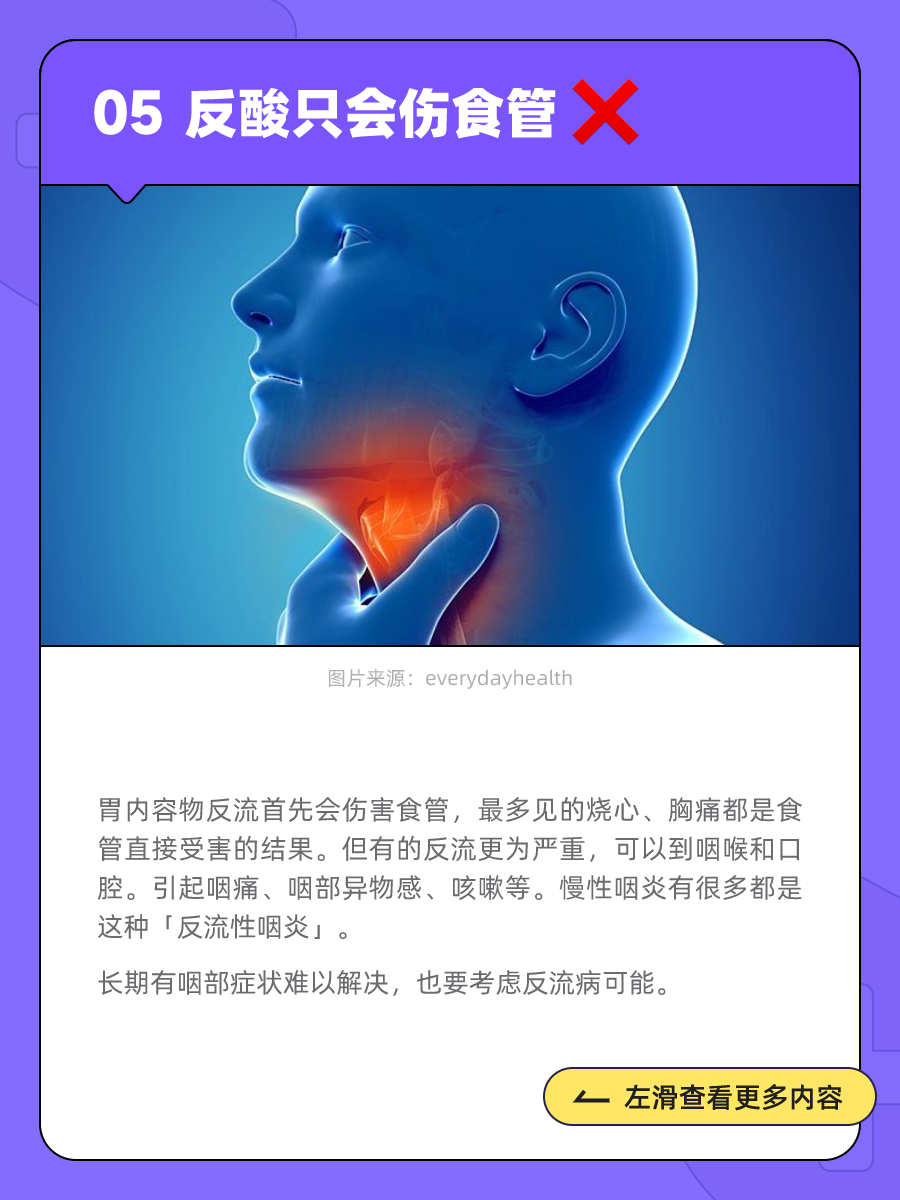 经常感觉胃反酸,是怎么回事?