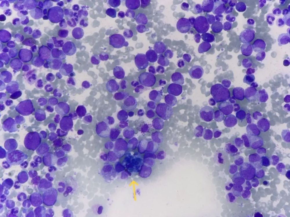 "海蓝组织细胞"知多少_腾讯新闻