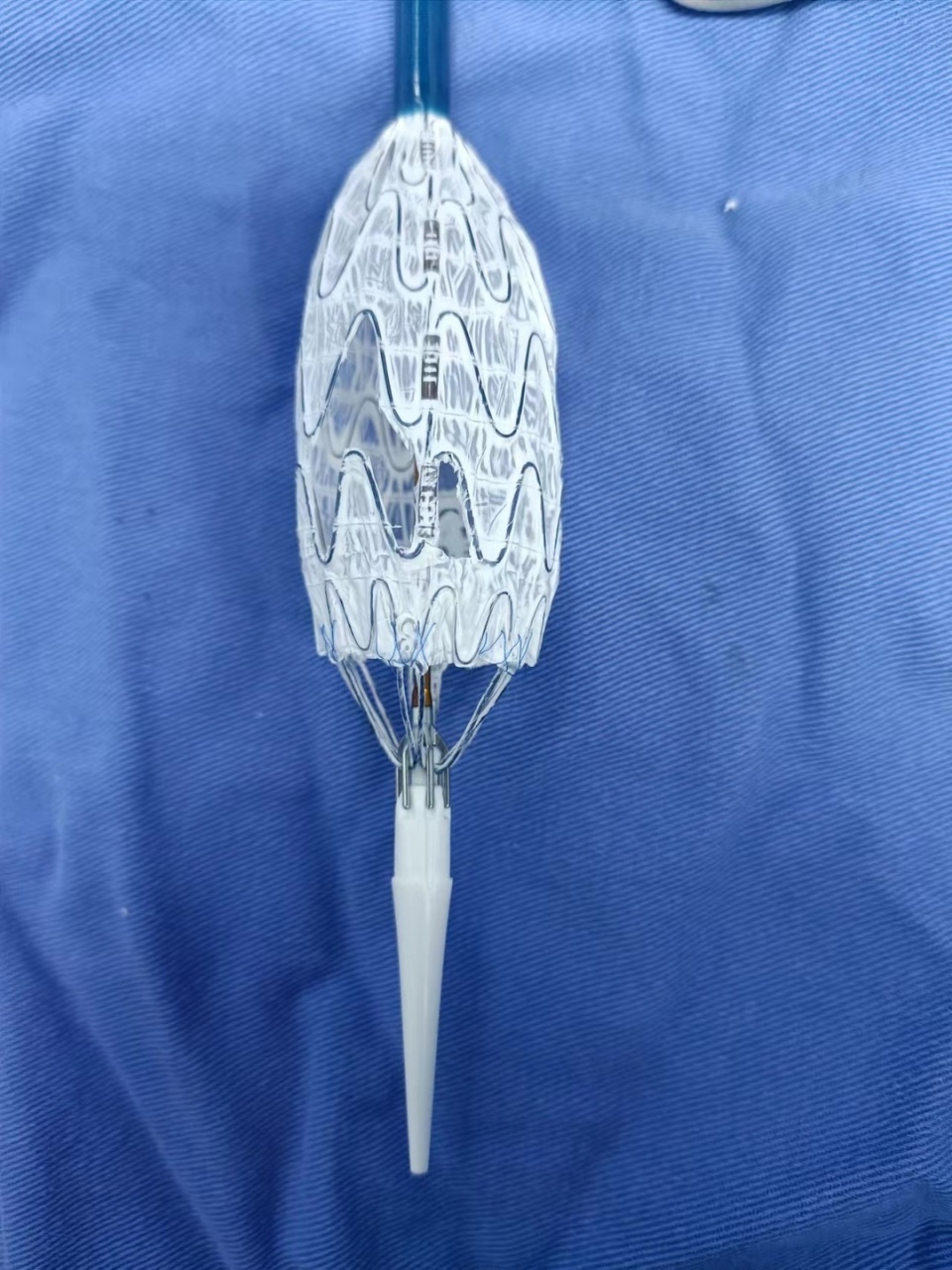 湘南学院附属医院丨体外支架"双开窗",重建主动脉生命通道