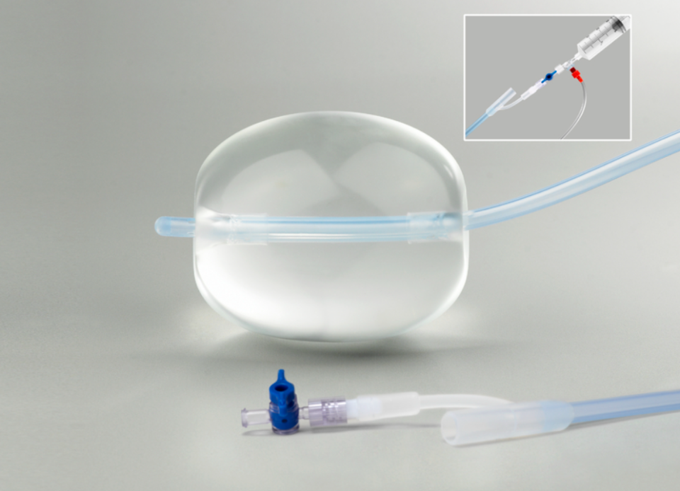 bakri球囊是一种宫腔填塞球囊,2012年引入中国,治疗产后出血的有效性