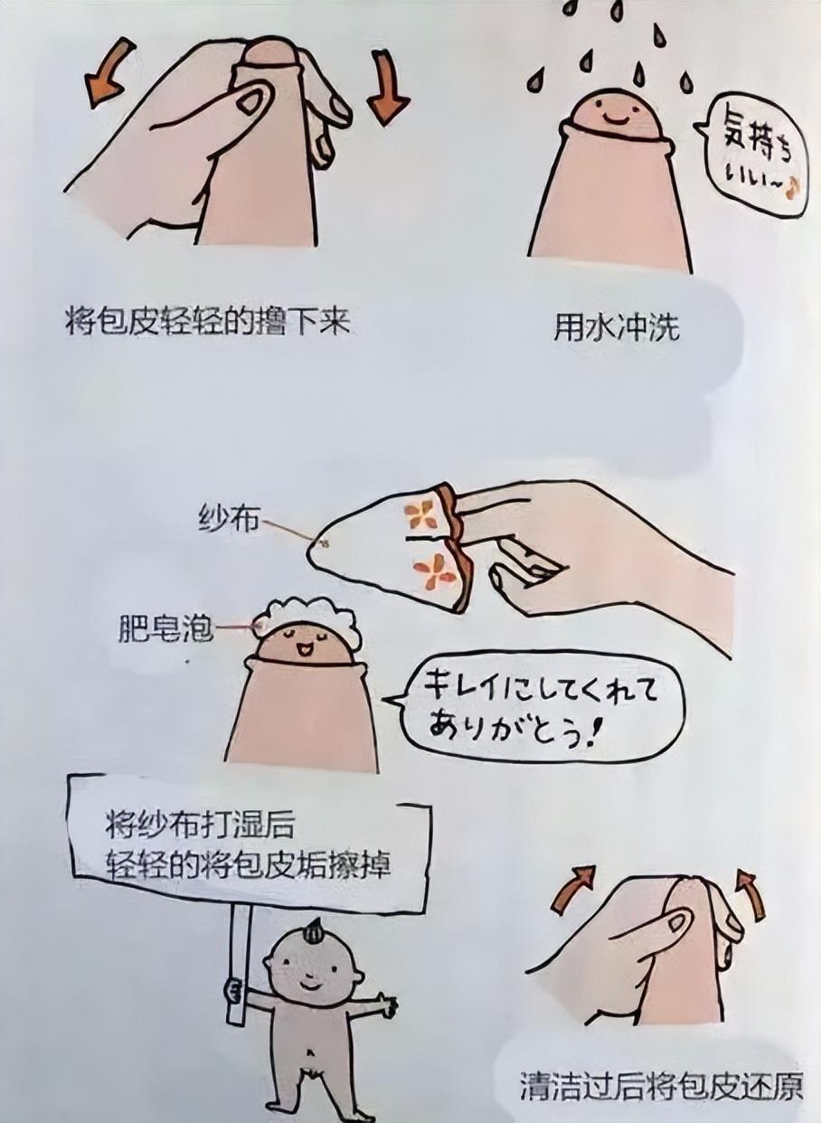 一到暑假就想带娃去割包皮?家长们先莫慌!