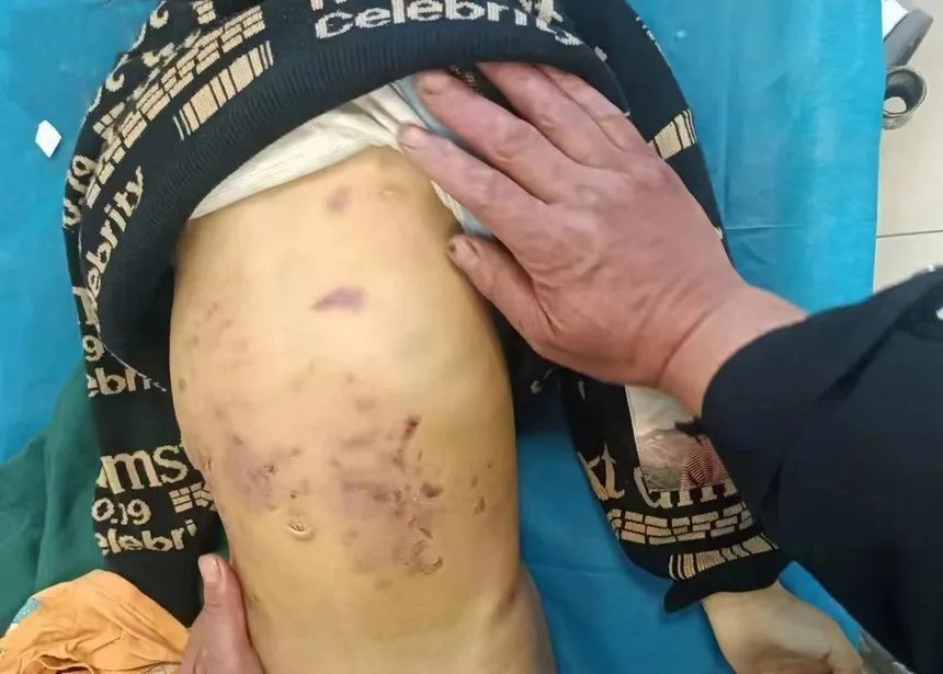 山东威海警方通报5岁男童疑被打致死事件:男童生母与其男友已被刑拘