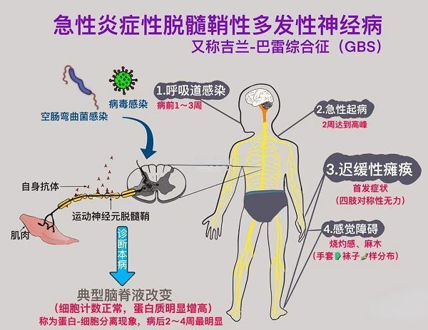 神经退行性疾病图片