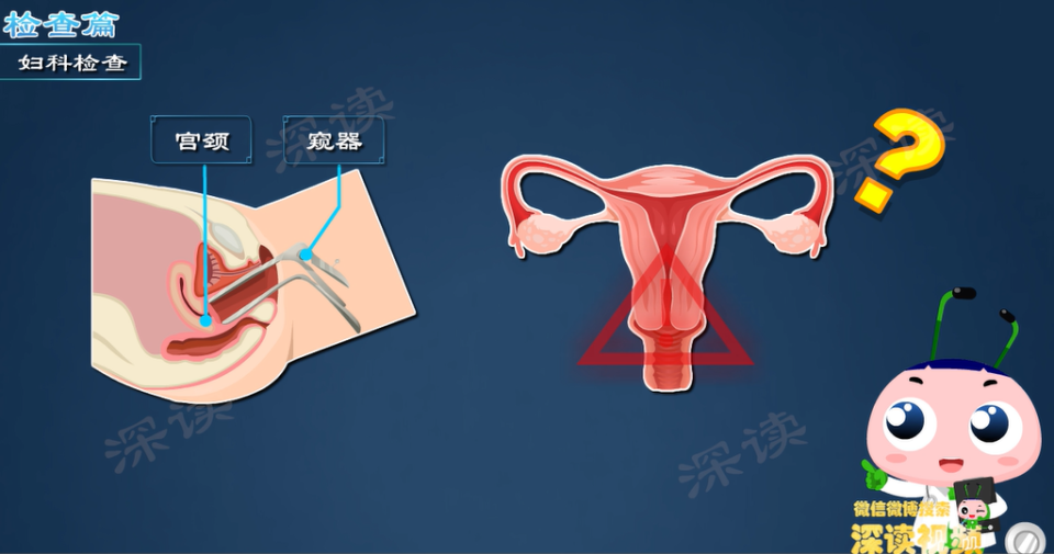 检查竟已是癌症?宫颈有没有炎症,看看白带就知道!