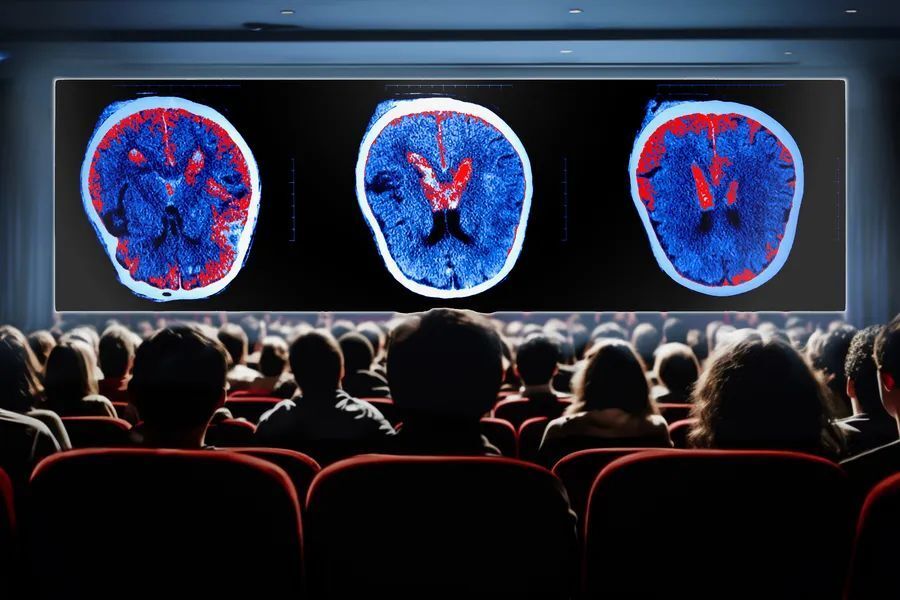 心电图机器怎么看追问weekly ｜ 过去一周，脑科学领域有哪些新发现？_https://www.jmylbn.com_新闻资讯_第7张