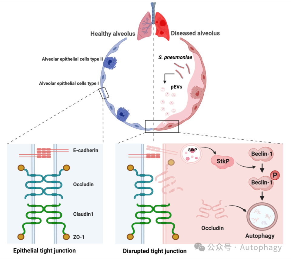 autophagy 