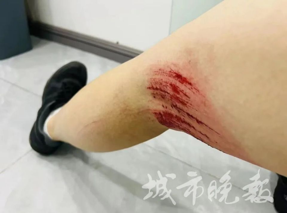 长春街头突发有人受伤谁来管