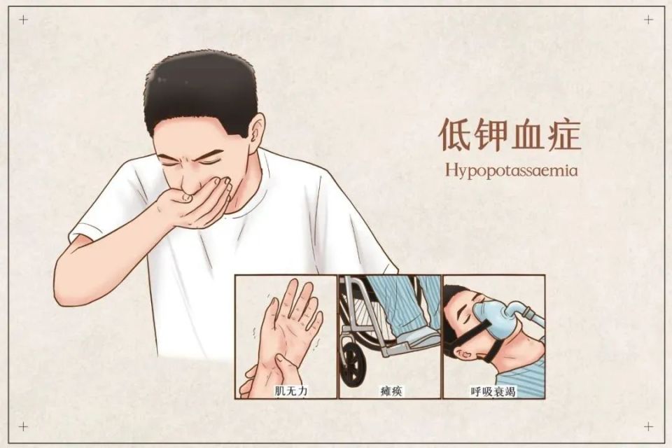 夏天浑身乏力提不起精神？小心是身体缺钾在作祟！缺钾原因你知道