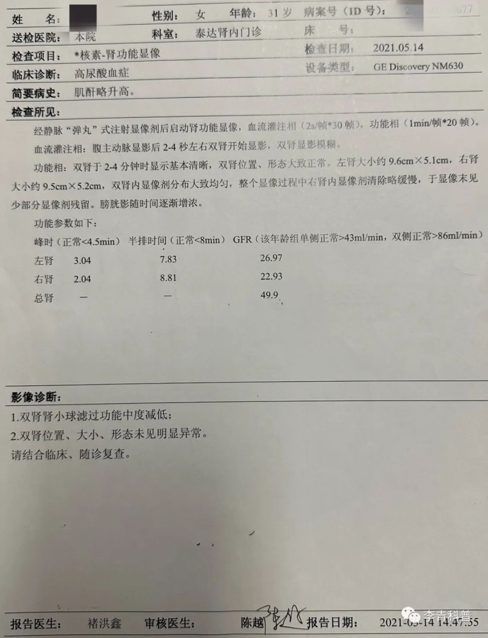 ect检查图片