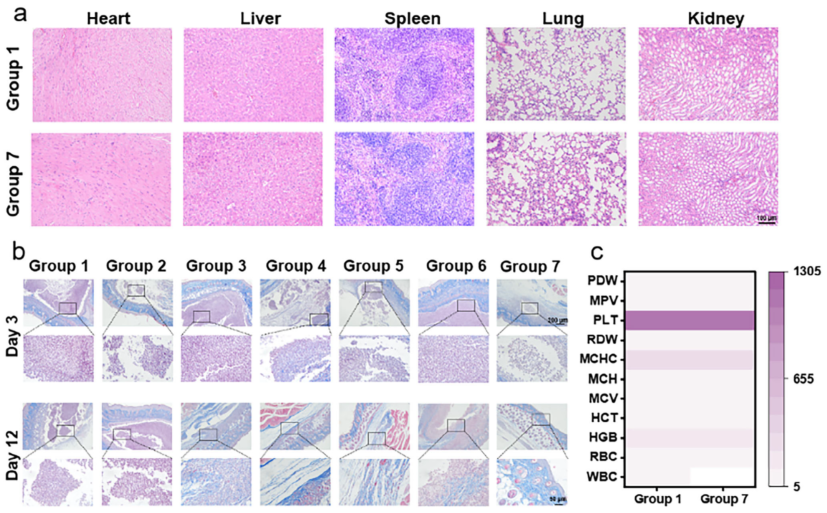 医用抗菌水凝胶怎么用南京工业大学AFM：新型可注射水凝胶为糖尿病脓肿治疗提供级联抗菌新策略_https://www.jmylbn.com_新闻资讯_第9张