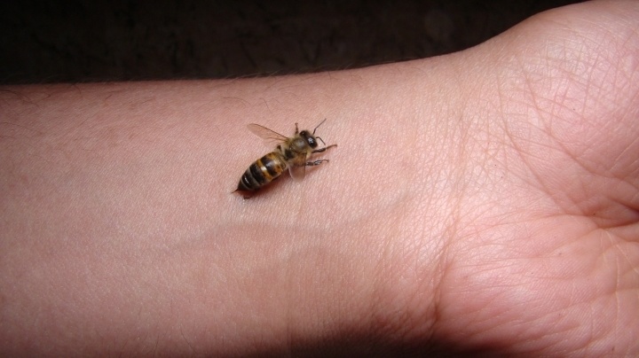 蜜蜂咬了伤口图图片