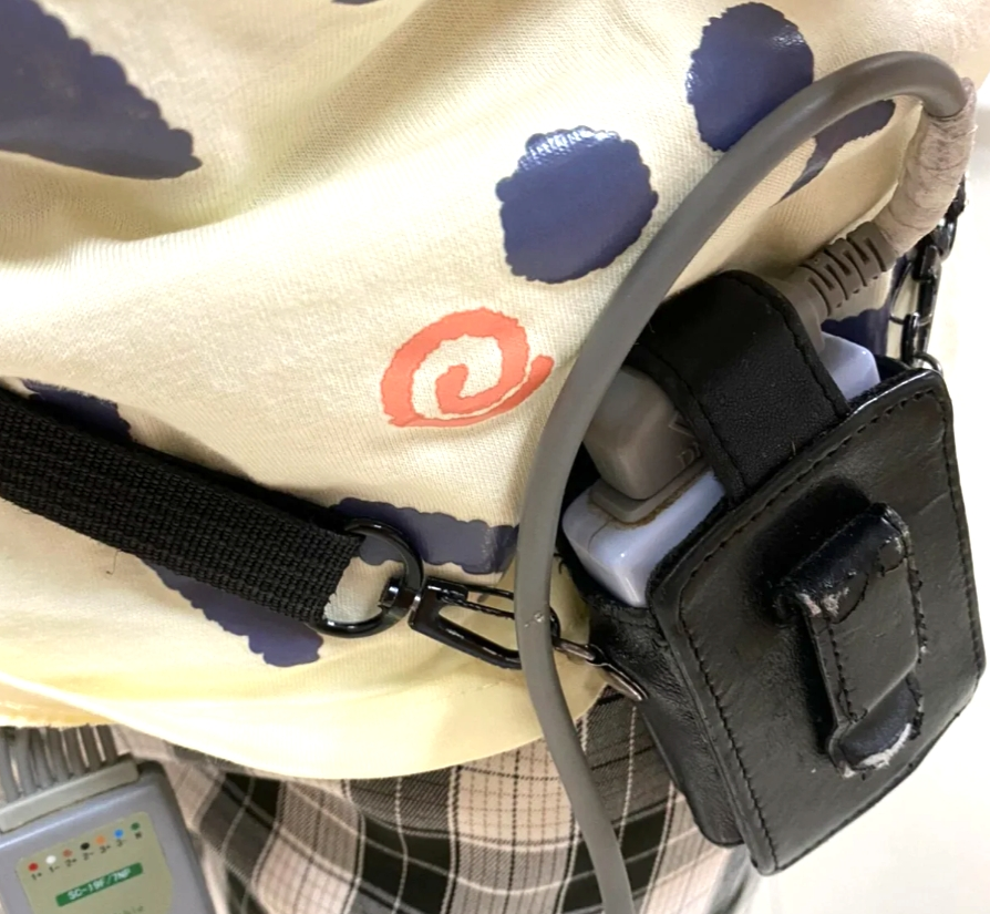 心电图机怎么维护别等“系统报错”才想起维护：一份写给当代打工人的心脏运维指南_https://www.jmylbn.com_新闻资讯_第10张