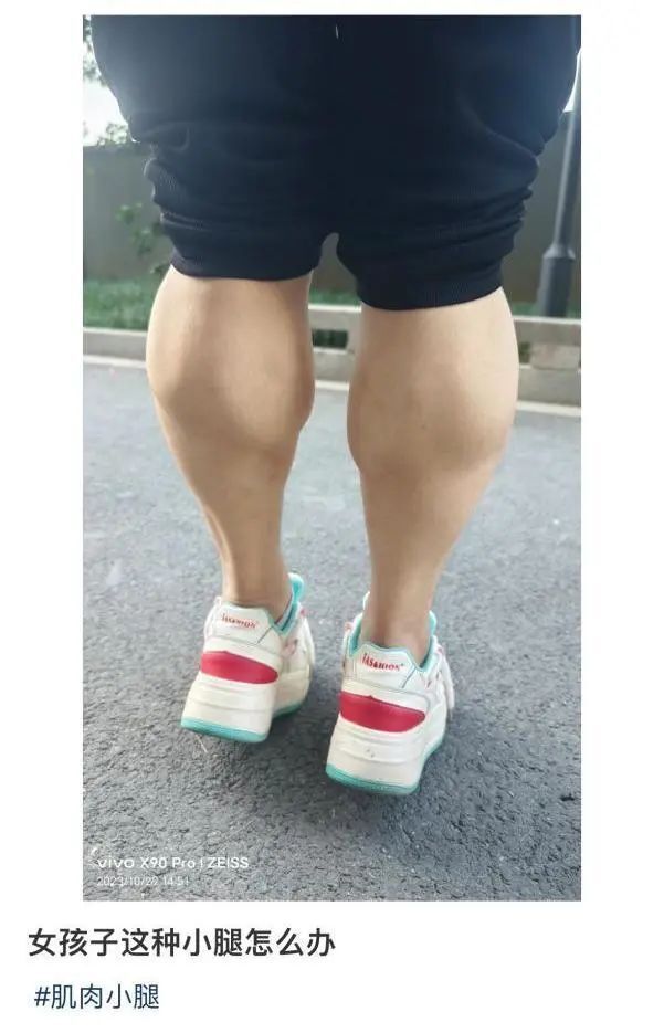 肌肉脂肪混合型小腿图片