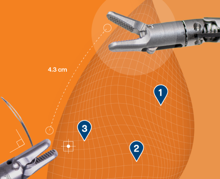 storz器械为什么好“达芬奇终结者”，面临破产？_https://www.jmylbn.com_新闻资讯_第9张