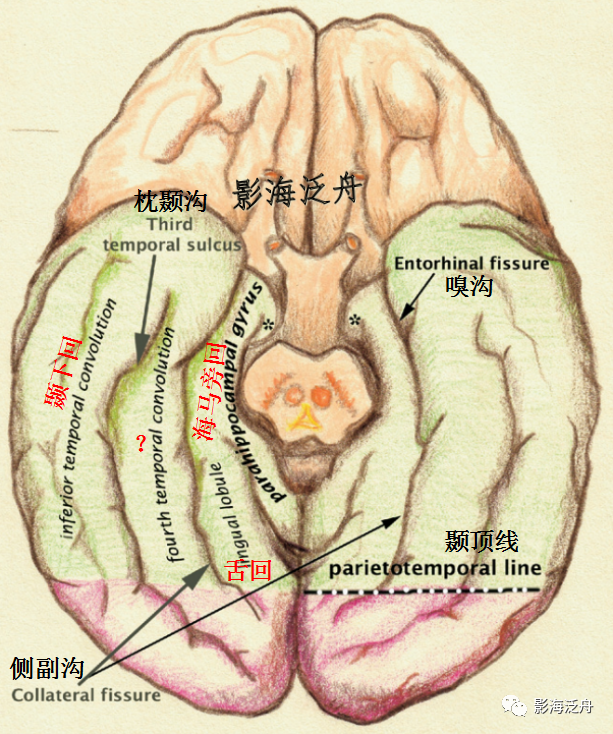 颞叶沟回图片