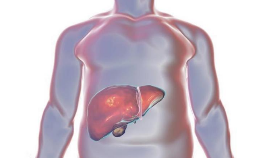 肝变硬头部能看出来?