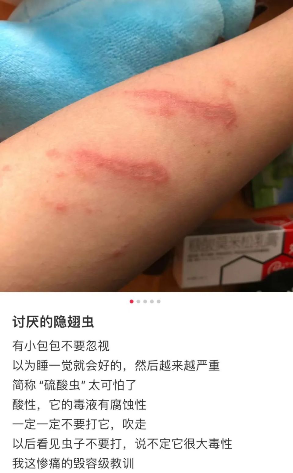 "最近别穿这种颜色的衣服出门"上热搜,招人烦的小飞虫为何偏爱黄绿色?