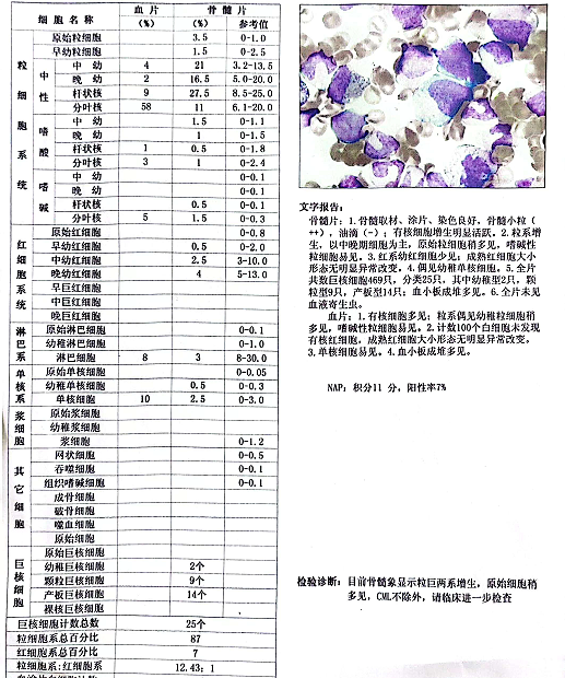 与经典慢性粒细胞白血病不同的少见血象形态学改变