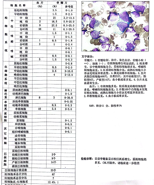 慢性粒细胞白血症图片