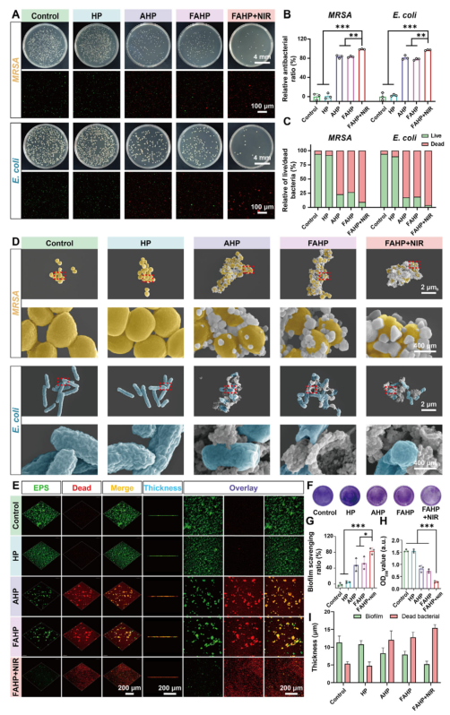 抗菌敷料有哪些西安交大AM：新型自进化水凝胶敷料，为感染性糖尿病伤口愈合提供时空精准调控新策略_https://www.jmylbn.com_新闻资讯_第8张