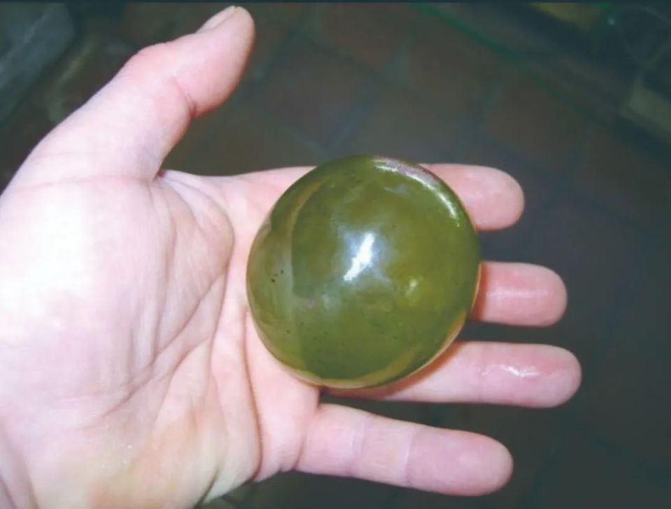 世界上最大的单细胞生物_腾讯新闻