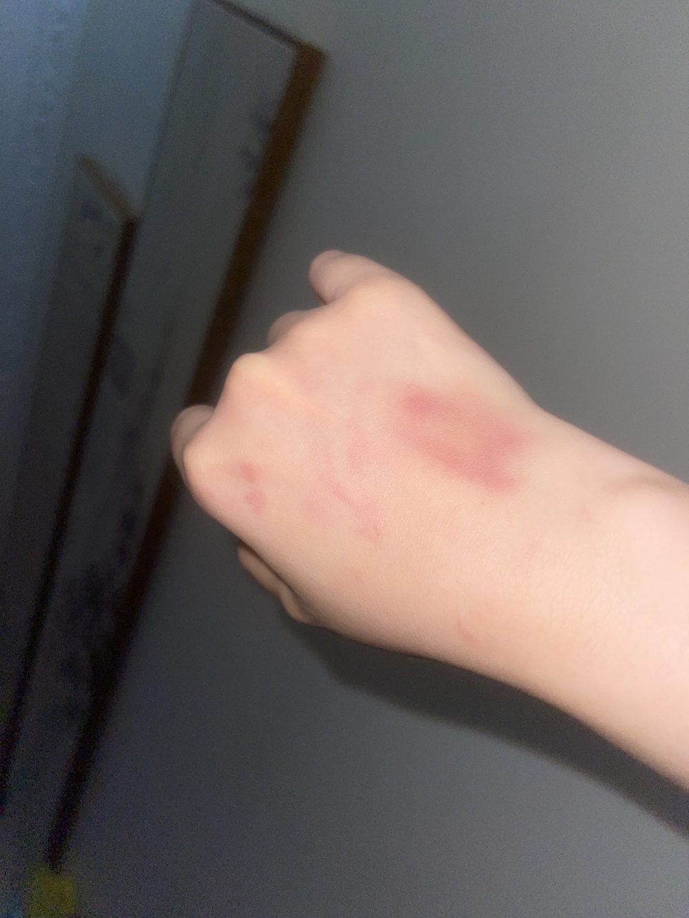 电梯内自家狗的尾巴扫到对方腿，女子称遭一对夫妇推搡扯衣致胸部裸露-腾讯新闻