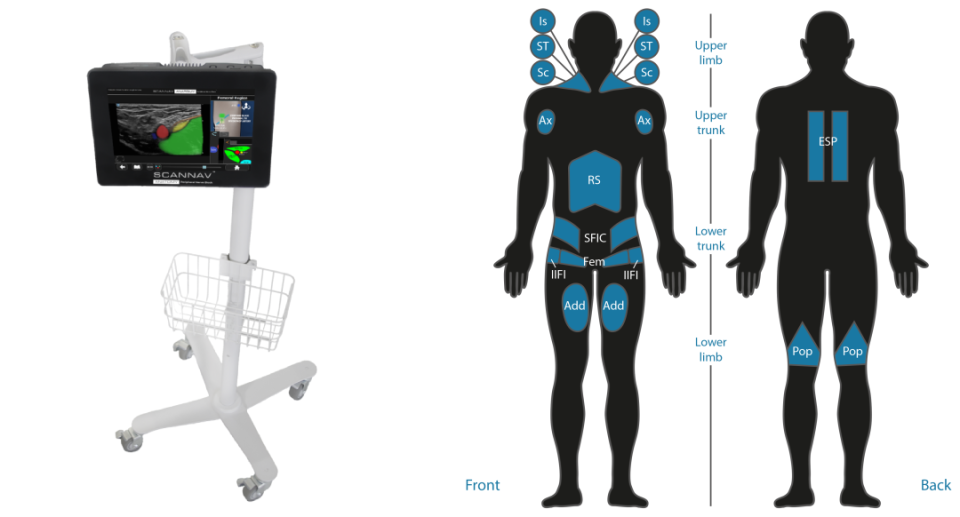 ge医疗器械怎么样GE医疗，加码这一领域_https://www.jmylbn.com_新闻资讯_第3张
