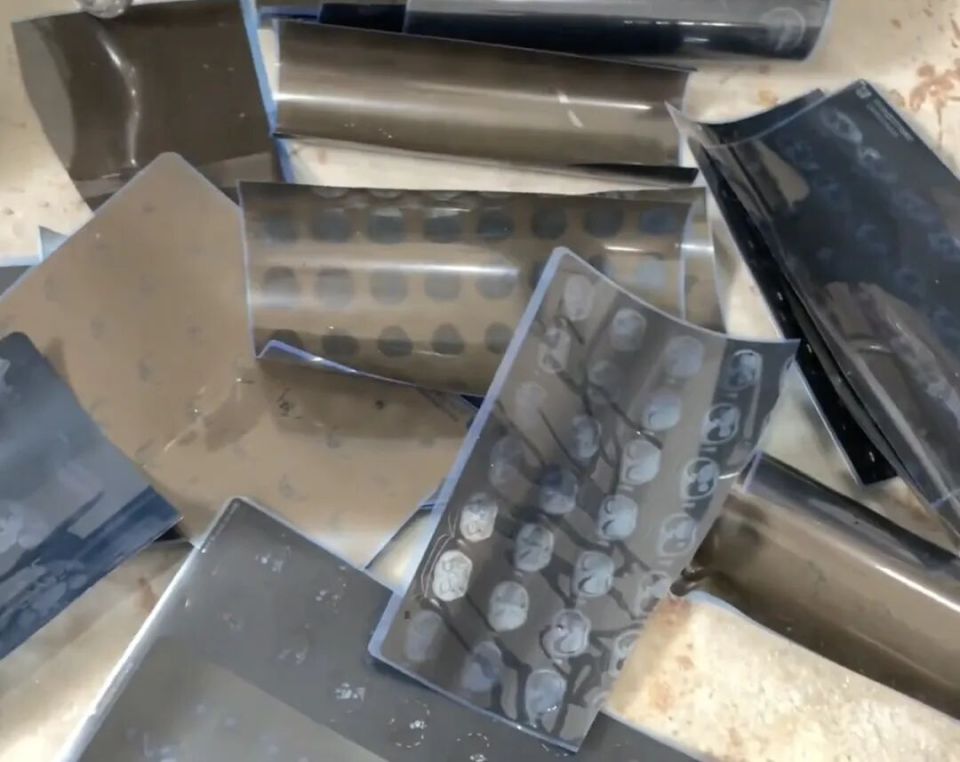 医用胶片怎么装CT胶片突然“值钱了”，有人称赚了近两万元！不少人家里都有，律师提醒_https://www.jmylbn.com_新闻资讯_第3张