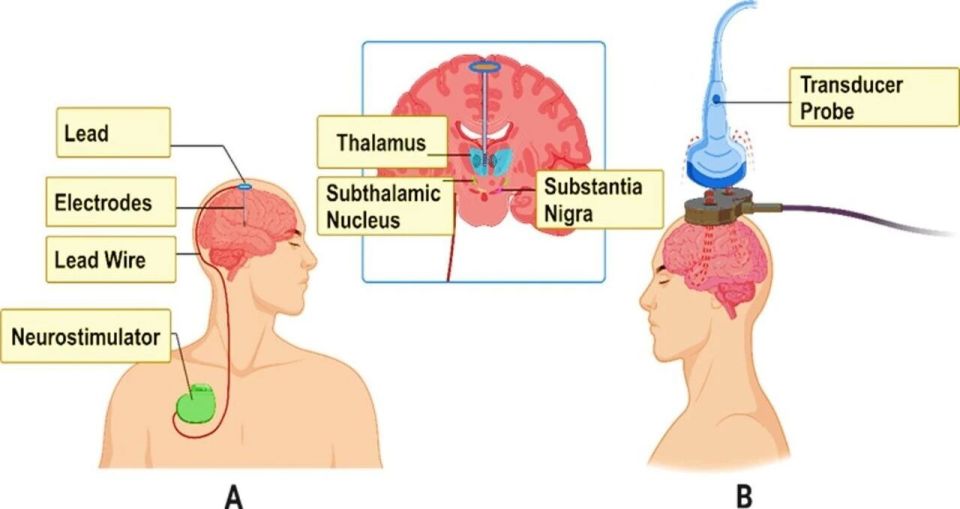 med复制粘贴怎么移动追问daily ｜ Nature：疼痛神经元是过敏反应的幕后推手；OpenAI打造健康助手_https://www.jmylbn.com_新闻资讯_第4张