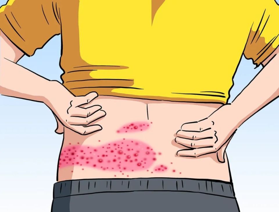 【漫绘科普】带状疱疹病毒,竟有两幅面孔?_腾讯新闻