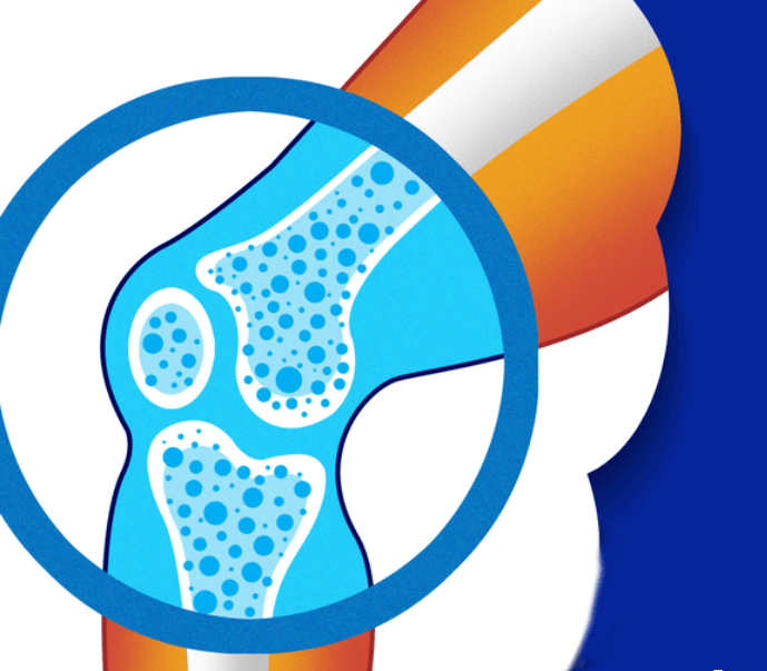 关于骨密度检查,您想知道的都在这儿!