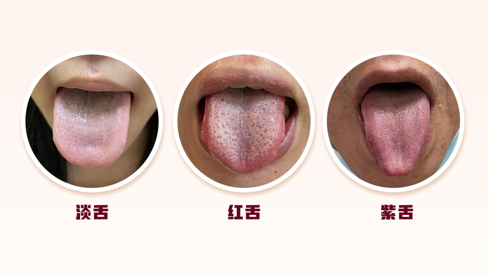体内有病，舌头先知？医生提醒：这些变化可能暗示脏腑出现疾病_腾讯新闻