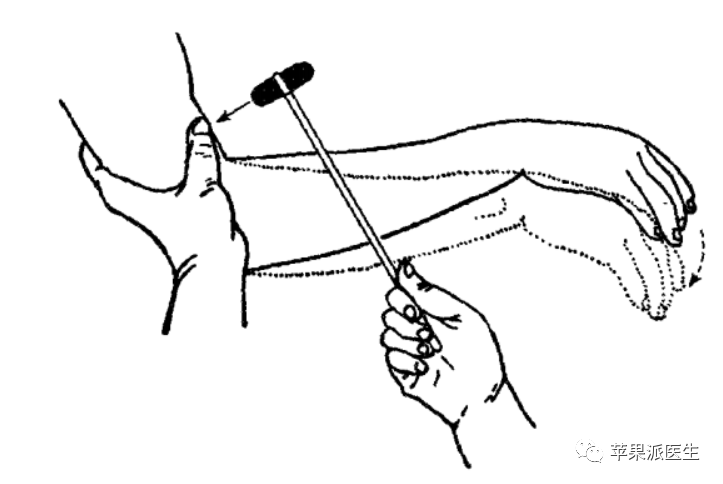 技能考试锦囊|神经反射检查之腱反射怎么敲_腾讯新闻