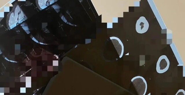 1.5元收一张旧CT片？专家提醒：别卖！非法炼银污染环境还致癌缩略图