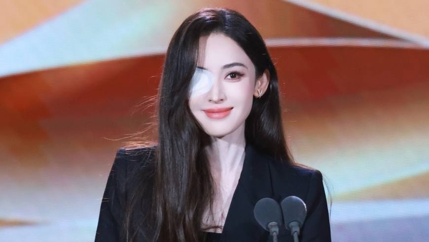 娜扎回应眼睛问题，称是小时候留下的病根，可能会考虑做手术
